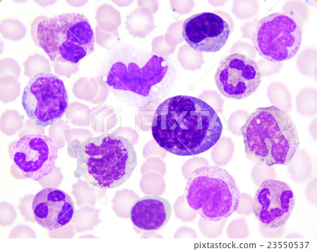 Leukocyte cell in blood smear 23550537