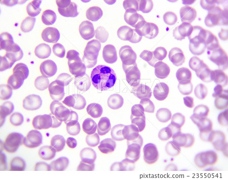 White blood cell in peripheral blood smear 23550541