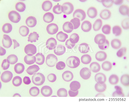 Target cells 23550562