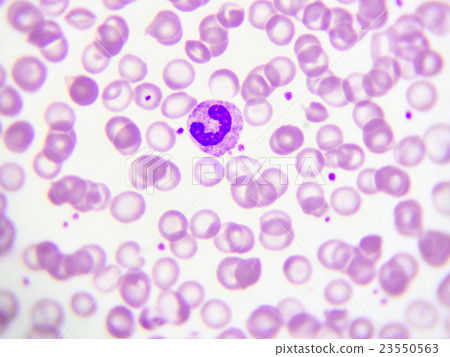 Neutrophil cell in blood smear 23550563