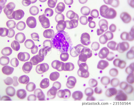 Monocyte cells in blood smear 23550564