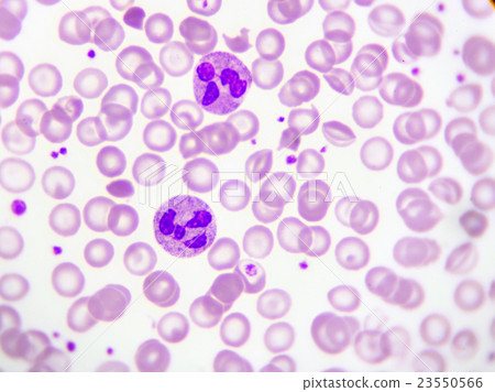 Neutrophil cell in blood smear Neutrophil cell in blood smear 23550566