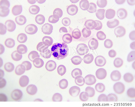 Neutrophil cell in blood smear 23550569