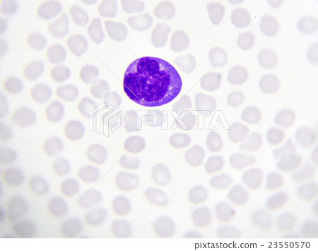 Neutrophil cell in blood smear 23550570