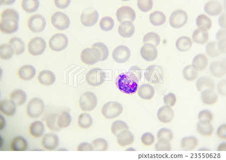 Malaria Parasite In Blood Smear Stock Photo 23550628 Pixta