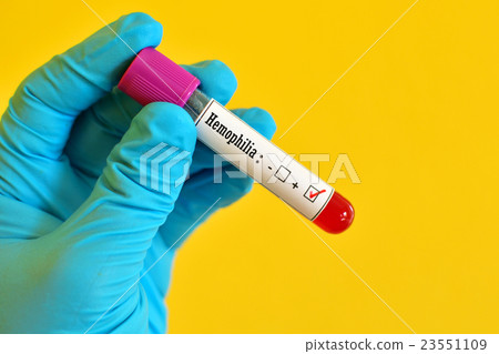 Hemophilia positive Hemophilia positive 23551109