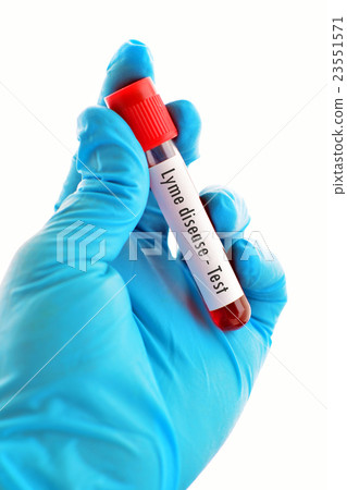 Blood sample for Lyme disease testing Blood sample for Lyme disease testing 23551571
