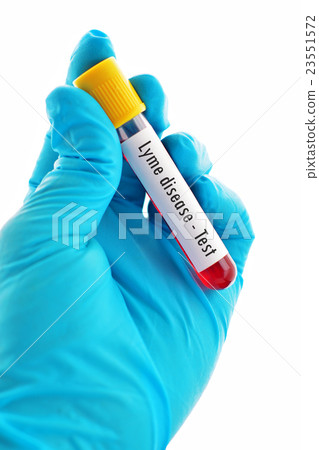 Blood sample for Lyme disease testing Blood sample for Lyme disease testing 23551572