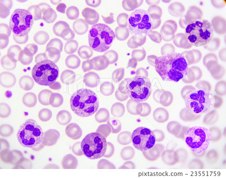 Neutrophil cells in blood smear 23551759
