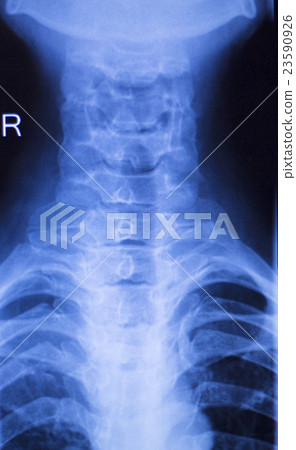 Neck and spine injury xray scan 23590926