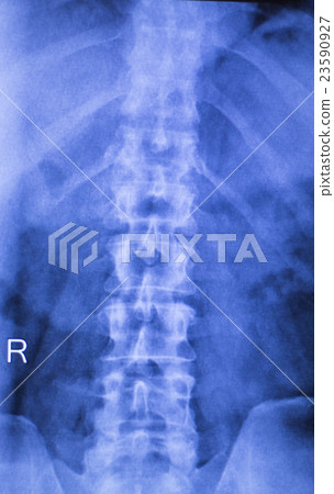 Neck and spine injury xray scan 23590927