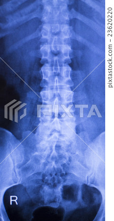 Neck and spine injury xray scan Neck and spine injury xray scan 23620220