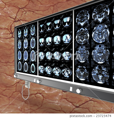 Closeup of a CT scan with brain 3d illustration 23723474
