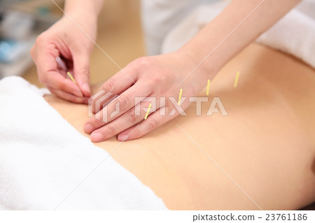 Acupuncture image Acupuncture image 23761186