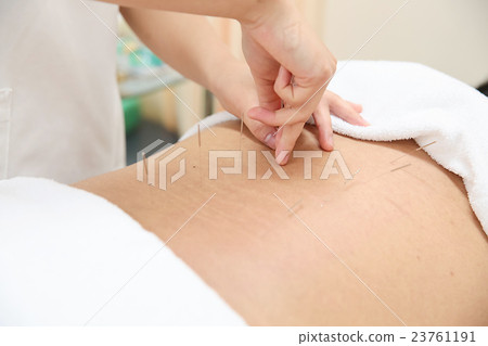 針灸圖像 23761191