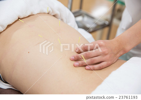針灸圖像 23761193