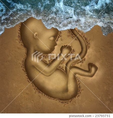 Miscarriage Miscarriage 23793731