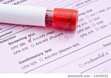 Sample blood collection tube. 23836491