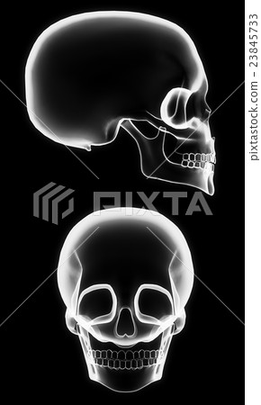 X-ray skull 23845733