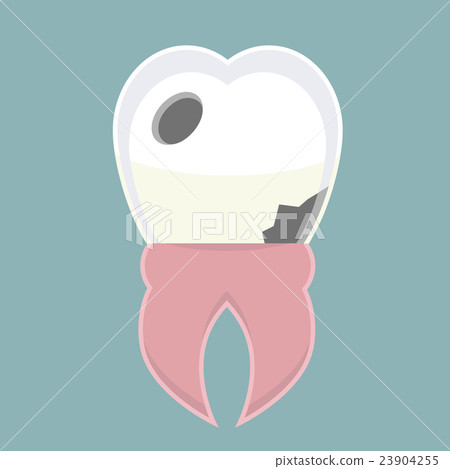 Caries 23904255