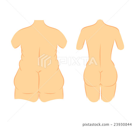 Butt lift correction waist line 23930844