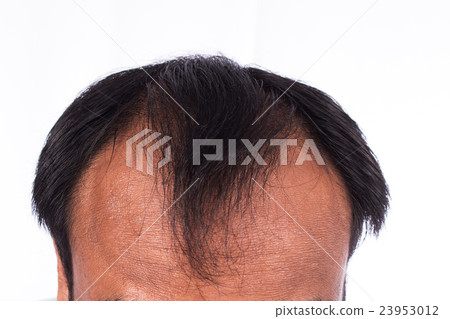 bald head of young man on white background 23953012
