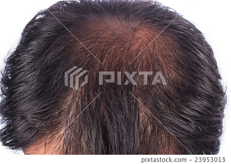 bald head of young man on white background 23953013
