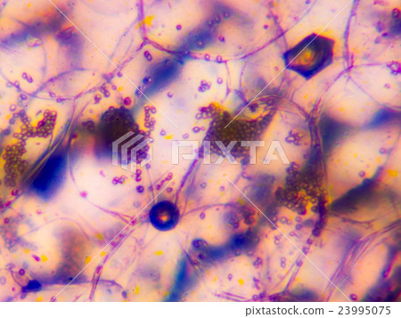 Micrograph (golden tree) Micrograph (golden tree) 23995075
