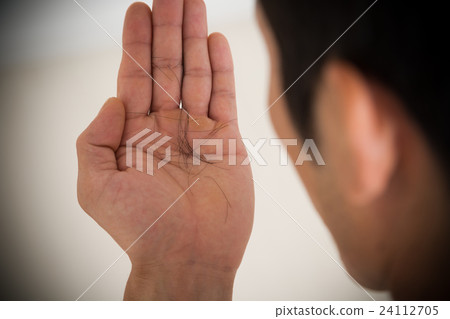 脫髮的年輕男子 24112705