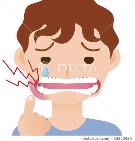 Children's toothache · Stomatitis 24230420