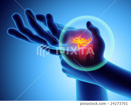 Wrist painful - skeleton x-ray. 24273701