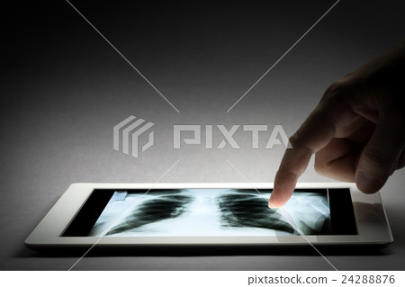 Human X-ray film exam by doctor Human X-ray film exam by doctor 24288876