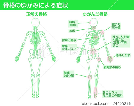 Skeletal Distortion Stock Illustration