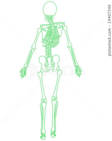 Skeletal distortion 24407348