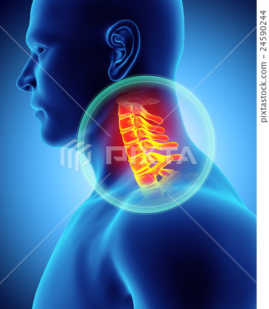 Neck painful - cervica spine, 3D illustration. 24590244