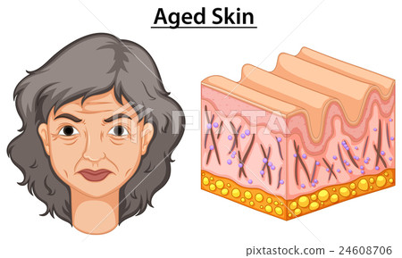 Diagram showing woman with aged skin Diagram showing woman with aged skin 24608706