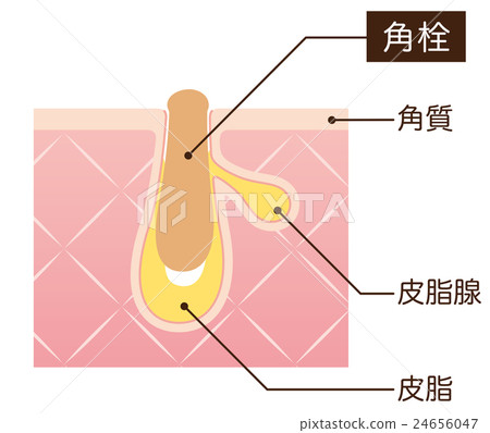 Structure of pores Rectangular plug sectional view Structure of pores Rectangular plug sectional view 24656047