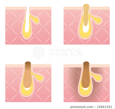 Structure of pores Rectangular plug sectional view Structure of pores Rectangular plug sectional view 24663381