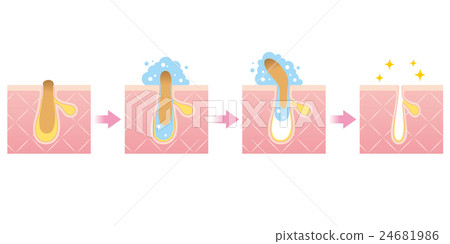 角塞清潔孔的結構 24681986