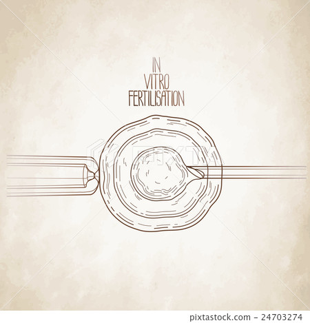 In vitor fertilisation 24703274