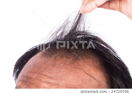 young men show hair 24720506