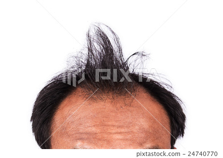 bald head of young man on white background bald head of young man on white background 24740770