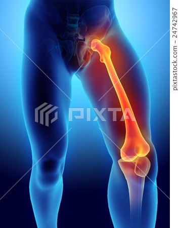 3D illustration of Femur, medical concept. 24742967