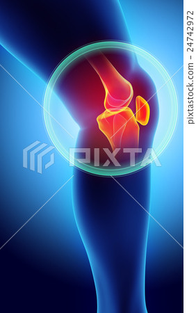 Knee painful - skeleton x-ray. 24742972