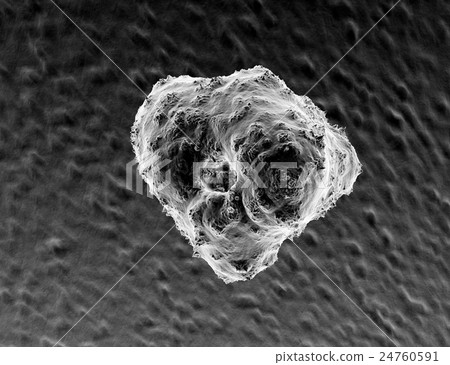 癌細胞CG 癌細胞CG 24760591