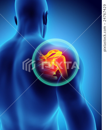 Shoulder painful skeleton x-ray, 3D illustration. 24767429