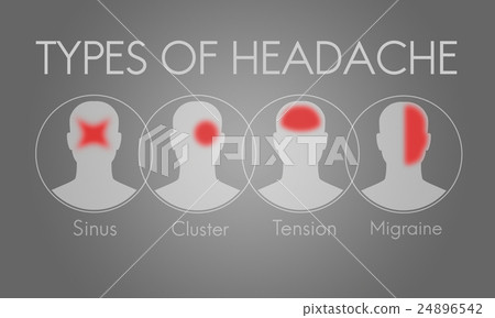 Headache Symptom Migraine Tension Cluster Concept - Stock Illustration ...