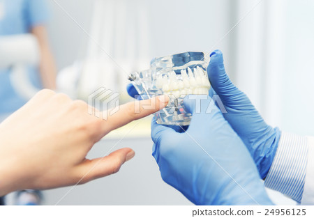 close up of dentist hands with teeth or jaw model 24956125