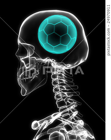 Xray of skull with soccer ball. Xray of skull with soccer ball. 24970911