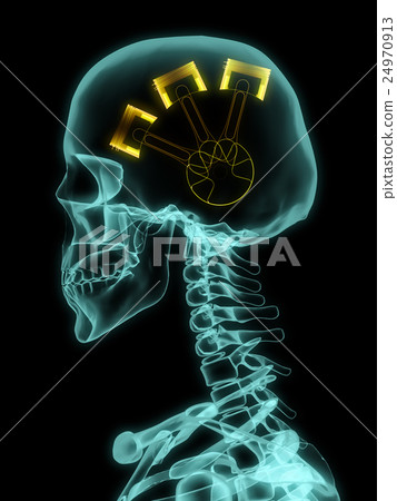 Xray of skull with engine. 24970913